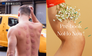 【知識】當針灸、拔罐走入運動恢復及治療  LVMH 也開始投資中醫