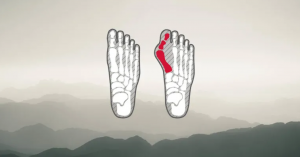 【登山鞋知識】專為拇趾外翻設計的登山鞋