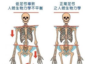 【登山醫學】下樑不正上樑歪！足底筋膜炎、下背痛都和它有關