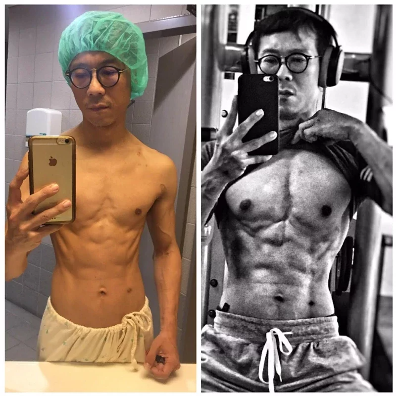 【人物】洗腎不能打敗我！ 洋蔥滿滿的洗腎健身路 弱男變硬漢助更多腎友