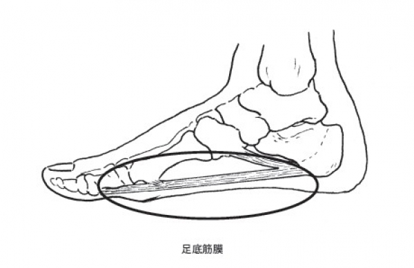 【登山醫學】足底筋膜炎