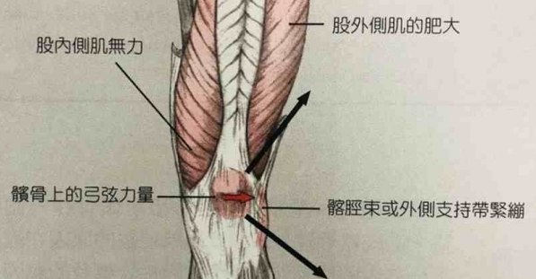 從肌礎做起i 被遺忘的股內側肌 網誌 運動筆記