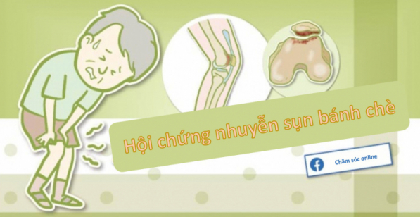 Những loại thực phẩm nào có thể làm tăng nguy cơ nhuyễn sụn xương bánh chè?
