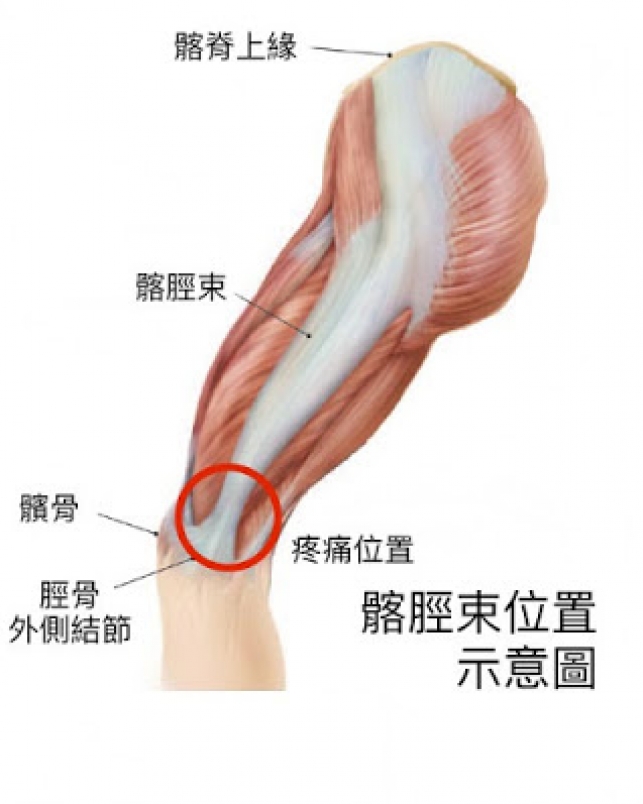 膝 原因 張 反 膝が後ろに反ってしまう反張膝の原因は？ ｜