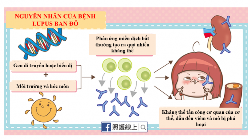 Cơ chế bệnh sinh lupus ban đỏ: Hiểu rõ để phòng ngừa và điều trị hiệu quả