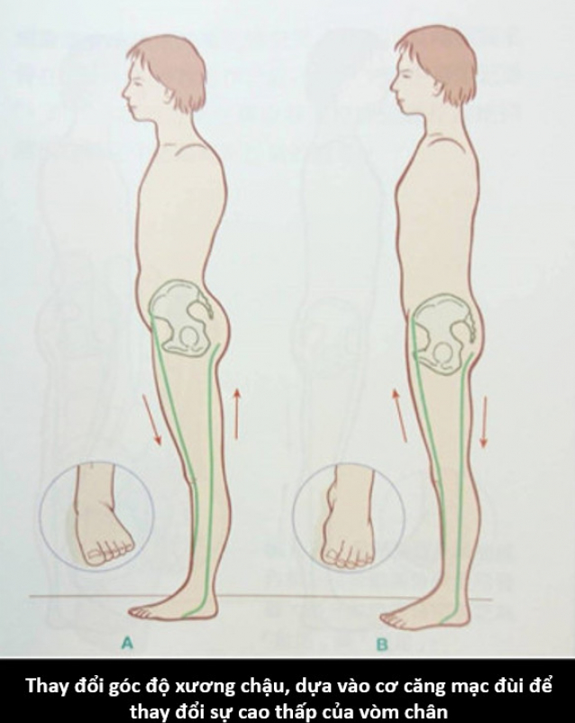 Xương Chậu Nhô Về Phía Trước: Triệu Chứng và Cách Khắc Phục