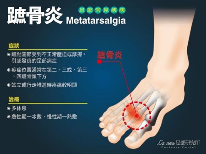 健走路跑常見9項足病症秘訣大公開 文章 運動筆記