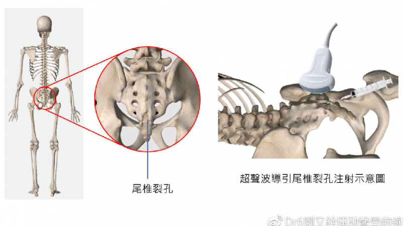 APT療法環椎骨盤調整法 | www.ddechuquisaca.gob.bo