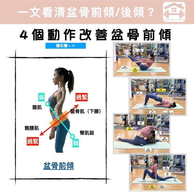 骨盆前傾 – 骨盆前傾原因 _ 骨盆前傾前因 …