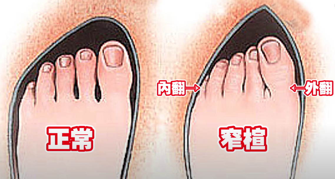 文章 運動筆記