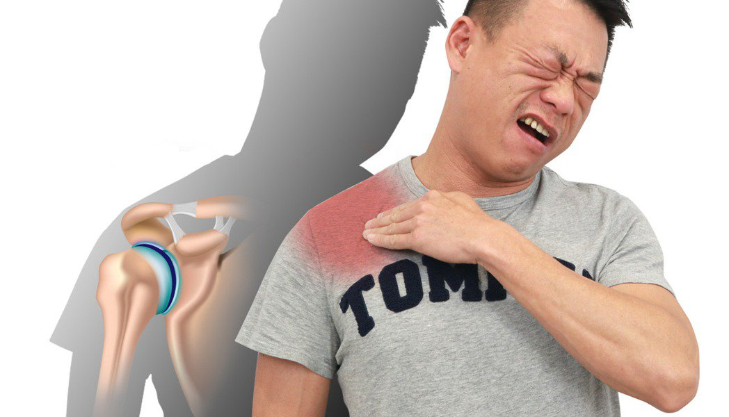 【健康】大多肩痛源自它！常被忽略而復元無期