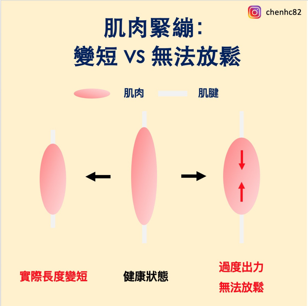 【知識】伸展放鬆卻沒效果？ 3 個原因讓你越做越緊繃